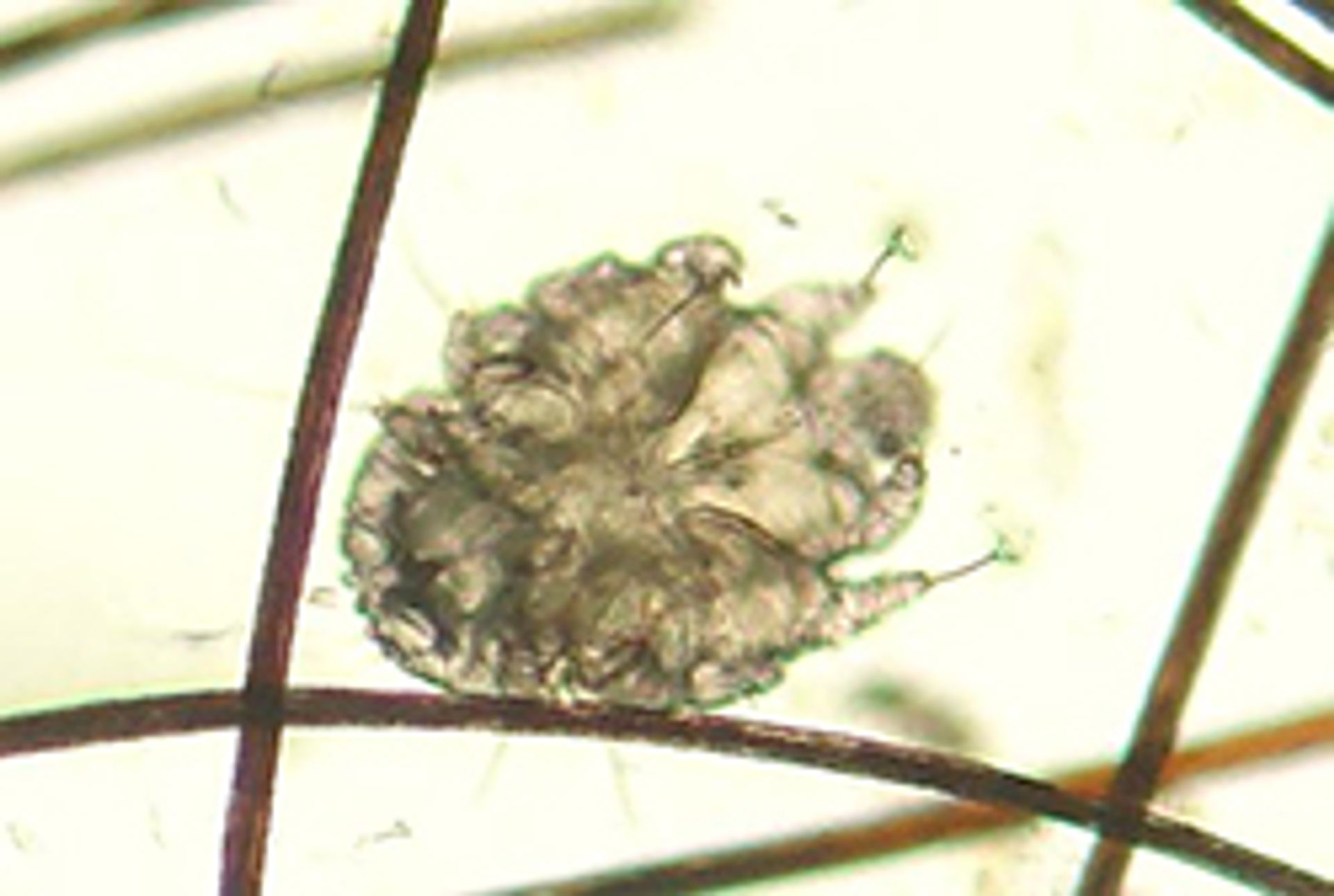Canine_scabies_mite2