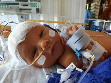 Thije deed als eerste baby ter wereld mee aan nieuw stamcelonderzoek