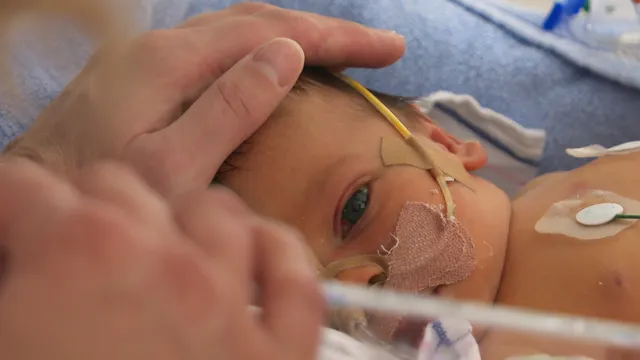 Baby Nomi uit het tv-programma Handen aan de couveuse.