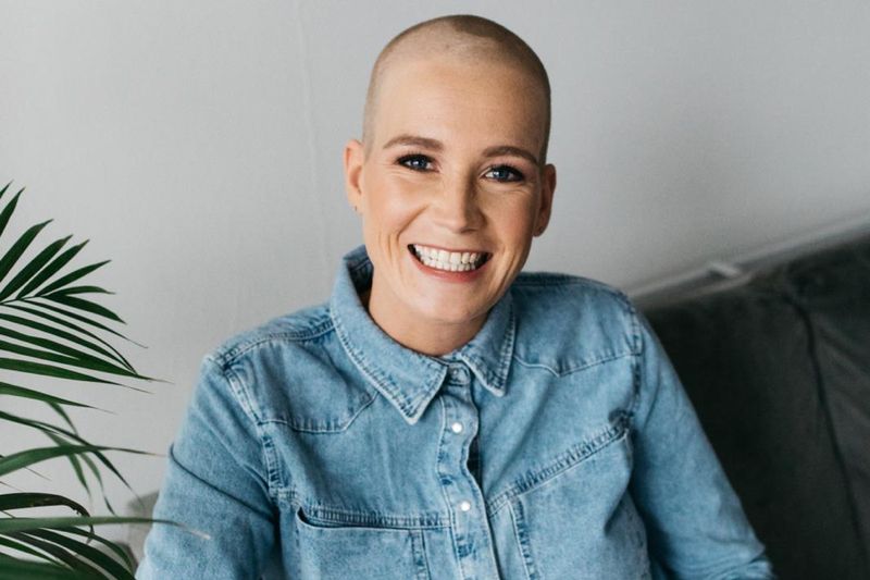 Model Sandra kreeg alopecia en werd in één keer kaal